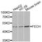 Ferrochelatase, mitochondrial antibody, STJ110716, St John