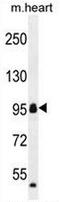 Coiled-Coil Domain Containing 110 antibody, AP50758PU-N, Origene, Western Blot image 