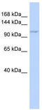 Zinc Finger CCCH-Type Containing 7B antibody, TA329408, Origene, Western Blot image 