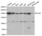 Rho Associated Coiled-Coil Containing Protein Kinase 2 antibody, LS-C334228, Lifespan Biosciences, Western Blot image 