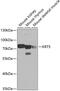 Keratin 5 antibody, 18-754, ProSci, Western Blot image 