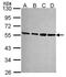 Proteasome 26S Subunit, Non-ATPase 4 antibody, GTX114678, GeneTex, Western Blot image 