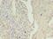 Keratin 8 antibody, LS-C370744, Lifespan Biosciences, Immunohistochemistry paraffin image 