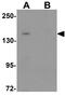 LINE1 Type Transposase Domain Containing 1 antibody, GTX32026, GeneTex, Western Blot image 