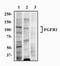 Fibroblast Growth Factor Receptor 1 antibody, NB100-2079, Novus Biologicals, Western Blot image 