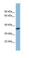 Pyridoxal Phosphatase antibody, orb326199, Biorbyt, Western Blot image 