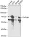 Zinc Finger Protein 264 antibody, 15-364, ProSci, Western Blot image 