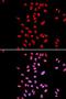Dyskerin Pseudouridine Synthase 1 antibody, LS-C331737, Lifespan Biosciences, Immunofluorescence image 