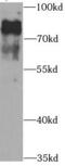 Potassium Voltage-Gated Channel Subfamily D Member 2 antibody, FNab04666, FineTest, Western Blot image 