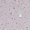 Ras Related GTP Binding D antibody, HPA068664, Atlas Antibodies, Immunohistochemistry paraffin image 