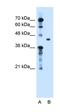 Transforming Growth Factor Beta Induced antibody, orb330378, Biorbyt, Western Blot image 