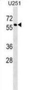 Mannose Phosphate Isomerase antibody, abx029275, Abbexa, Western Blot image 