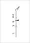 Olfactory Receptor Family 5 Subfamily M Member 8 antibody, 60-206, ProSci, Western Blot image 