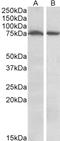 Serine/Threonine Kinase 39 antibody, LS-B8310, Lifespan Biosciences, Western Blot image 