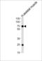 Golgi Associated Kinase 1B antibody, 57-385, ProSci, Western Blot image 