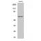 Heterogeneous Nuclear Ribonucleoprotein K antibody, LS-C383993, Lifespan Biosciences, Western Blot image 