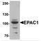Rap Guanine Nucleotide Exchange Factor 3 antibody, MBS150164, MyBioSource, Western Blot image 