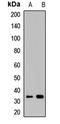 Osteoglycin antibody, LS-C667948, Lifespan Biosciences, Western Blot image 