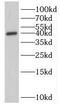 C-type lectin domain family 4 member K antibody, FNab04692, FineTest, Western Blot image 