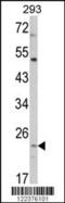 ATP Synthase Peripheral Stalk Subunit OSCP antibody, MBS9208252, MyBioSource, Western Blot image 