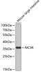 Melanocortin 3 Receptor antibody, GTX54376, GeneTex, Western Blot image 