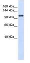 Calcium Homeostasis Endoplasmic Reticulum Protein antibody, GTX15951, GeneTex, Western Blot image 