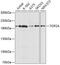 DNA Topoisomerase II Alpha antibody, 13-266, ProSci, Western Blot image 