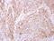 Ethanolamine kinase 1 antibody, PA5-28325, Invitrogen Antibodies, Immunohistochemistry frozen image 