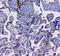 Integrin Subunit Alpha 5 antibody, A01911, Boster Biological Technology, Immunohistochemistry paraffin image 
