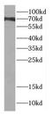 DM1 Locus, WD Repeat Containing antibody, FNab02428, FineTest, Western Blot image 