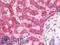 Perilipin 2 antibody, LS-B10434, Lifespan Biosciences, Immunohistochemistry paraffin image 