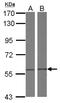 Chaperonin Containing TCP1 Subunit 4 antibody, NBP2-20587, Novus Biologicals, Western Blot image 