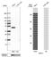 Mesothelin antibody, NBP1-88224, Novus Biologicals, Western Blot image 