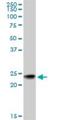RAB7B, Member RAS Oncogene Family antibody, H00338382-M01, Novus Biologicals, Western Blot image 