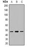 Calcium Voltage-Gated Channel Auxiliary Subunit Gamma 5 antibody, orb382492, Biorbyt, Western Blot image 