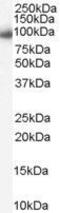 Karyopherin Subunit Beta 1 antibody, GTX89314, GeneTex, Western Blot image 