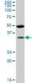 Barttin CLCNK Type Accessory Beta Subunit antibody, H00007809-B01P, Novus Biologicals, Western Blot image 