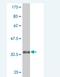 EPH Receptor A5 antibody, H00002044-M03, Novus Biologicals, Western Blot image 