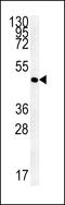 Alpha And Gamma Adaptin Binding Protein antibody, LS-C166176, Lifespan Biosciences, Western Blot image 