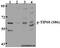 Lysine Acetyltransferase 5 antibody, A01393S86, Boster Biological Technology, Western Blot image 