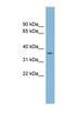 Transmembrane Serine Protease 12 antibody, NBP1-91466, Novus Biologicals, Western Blot image 