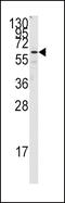 Frizzled Class Receptor 1 antibody, 61-488, ProSci, Western Blot image 