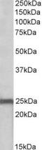 NADH:Ubiquinone Oxidoreductase Core Subunit S8 antibody, TA311237, Origene, Western Blot image 