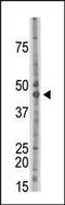 Casein Kinase 2 Alpha 1 antibody, PA5-15454, Invitrogen Antibodies, Western Blot image 