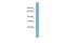 STIM Activating Enhancer antibody, A12304, Boster Biological Technology, Western Blot image 