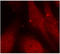 ABL Proto-Oncogene 1, Non-Receptor Tyrosine Kinase antibody, LS-C335025, Lifespan Biosciences, Immunofluorescence image 