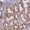 PWWP domain-containing protein 2A antibody, NBP2-13833, Novus Biologicals, Immunohistochemistry paraffin image 