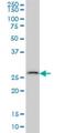 Carbonic Anhydrase 7 antibody, H00000766-M06, Novus Biologicals, Western Blot image 