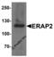 Endoplasmic reticulum aminopeptidase 2 antibody, 7469, ProSci Inc, Western Blot image 