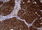 NME/NM23 Nucleoside Diphosphate Kinase 1 antibody, LS-C175584, Lifespan Biosciences, Immunohistochemistry paraffin image 